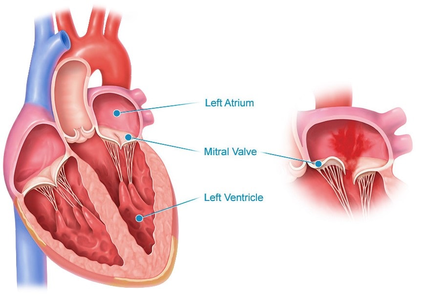 atrial septal defects, aortic stenosis, structural heart program